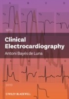 Clinical Electrocardiography  A Textbook