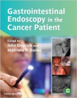 Gastrointestinal Endoscopy in Cancer Patient