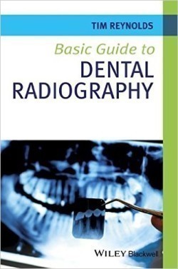 Basic Guide to Dental Radiography