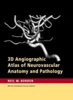 3D Angiographic Atlas of Neurovascular Anatomy and Pathology