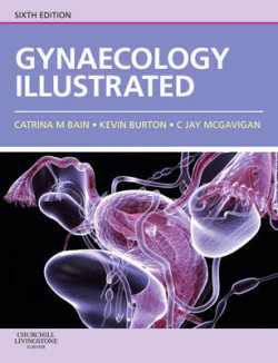 Gynaecology Illustrated 6th Ed.