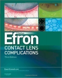 Contact Lens Complications, 3rd Ed.