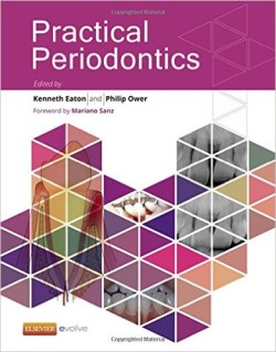 Churchill's Textbook of Periodontics : Practical Periodontics