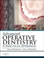 Advanced Operative Dentistry