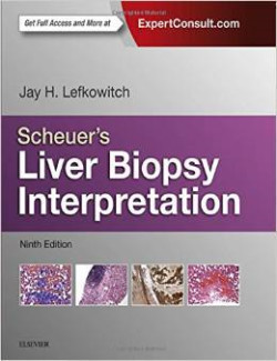 Scheuer's Liver Biopsy Interpretation, 9th Ed.