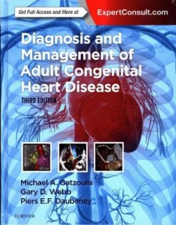 Diagnosis and Management of Adult Congenital Heart Disease