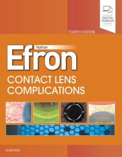 Contact Lens Complications*