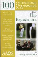 100 Questions  &  Answers About Hip Replacement