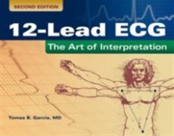 12-Lead ECG