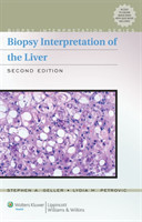 Biopsy Interpretation of Liver