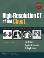 High-resolution Ct of Chest