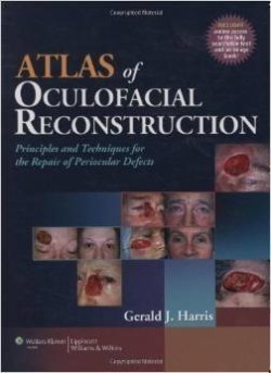 Atlas of Oculofacial Reconstruction : Principles and Techniques for the Repair of Periocular Defects