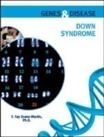 Down Syndrome