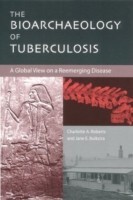 Bioarchaeology of Tuberculosis