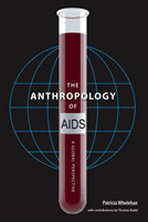 Anthropology of AIDS
