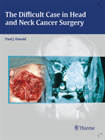 Difficult Case in Head and Neck Cancer Surgery