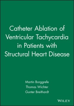 Catheter Ablation of Ventricular Tachycardia in Patients with Structural Heart Disease