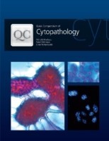 Quick Compendium of Cytopathology