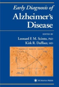 Early Diagnosis of Alzheimer’s Disease