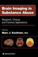 Brain Imaging in Substance Abuse