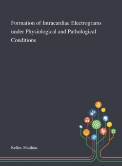 Formation of Intracardiac Electrograms Under Physiological and Pathological Conditions