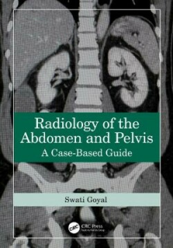 Radiology of the Abdomen and Pelvis