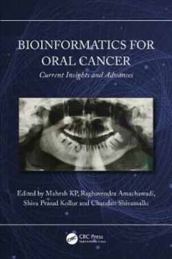 Bioinformatics for Oral Cancer