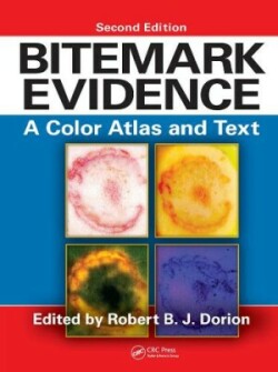 Bitemark Evidence