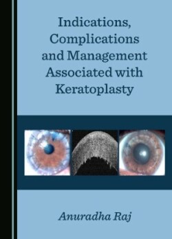 Indications, Complications and Management Associated with Keratoplasty