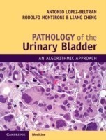 Pathology of the Urinary Bladder: An Algorithmic Approach