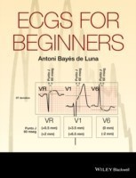 ECGs for Beginners