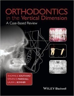 Orthodontics in the Vertical Dimension : A Case-Based Review