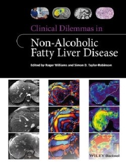 Clinical Dilemmas in Non-Alcoholic Fatty Liver Disease