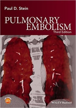 Pulmonary Embolism, 3rd Ed.