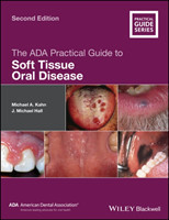 ADA Practical Guide to Soft Tissue Oral Disease