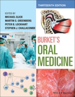 Burket's Oral Medicine, 13th Ed.