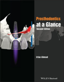 Prosthodontics at a Glance