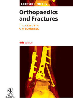 Lecture Notes: Orthopaedics and Fractures, 4th Ed.