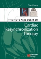 Nuts and Bolts of Cardiac Resynchronization Therapy