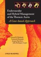 Endovascular and Hybrid Management of Thoracic Aorta