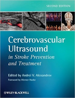 Cerebrovascular Ultrasound in Stroke Prevention and Treatment