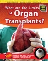 What Are the Limits of Organ Transplantation?