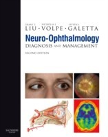 Neuro-ophthalmology: Diagnosis and Management