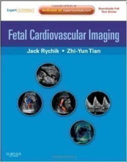 Fetal Cardiovascular Imaging