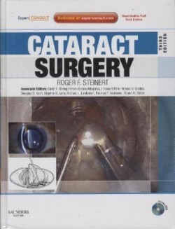 Cataract Surgery