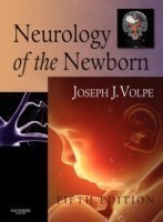 Neurology of Newborn