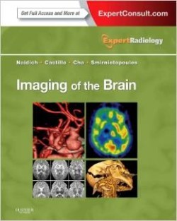 Imaging of the Brain : Expert Radiology Series