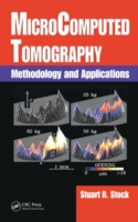 Microcomputed Tomography