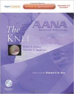AANA Advanced Arthroscopy: Knee : Expert Consult: Online, Print and DVD