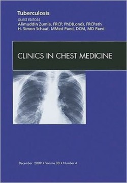 Tuberculosis, An Issue of Clinics in Chest Medicine